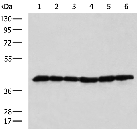 Rabbit Polyclonal Antibody to DNAJB11