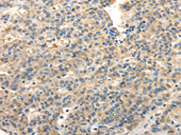 Rabbit Polyclonal Antibody to TWIST2