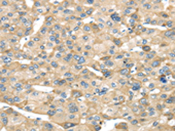 Rabbit Polyclonal Antibody to NME8