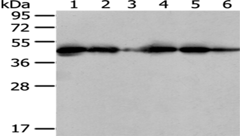 Rabbit Polyclonal Antibody to ERP44