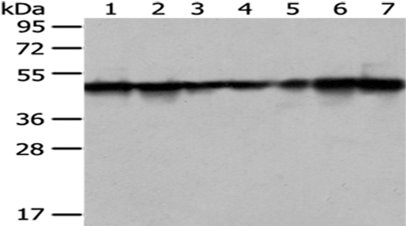 Rabbit Polyclonal Antibody to TXNDC5