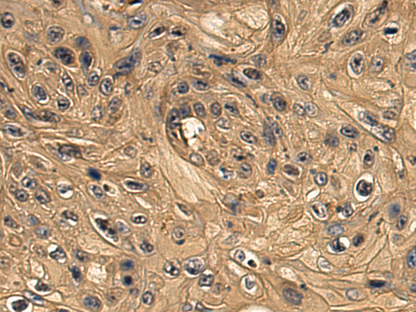 Rabbit Polyclonal Antibody to TXNDC17