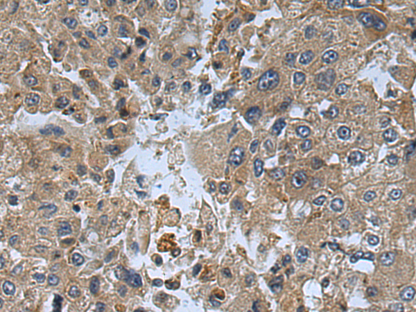 Rabbit Polyclonal Antibody to TYK2