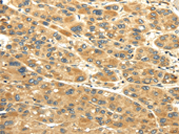 Rabbit Polyclonal Antibody to UACA