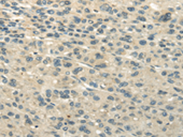 Rabbit Polyclonal Antibody to UBAP2L