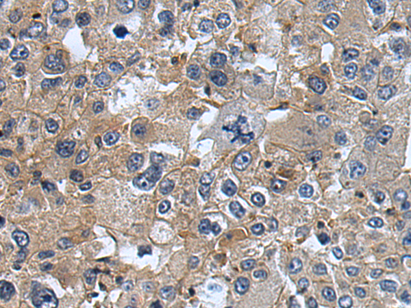 Rabbit Polyclonal Antibody to UBA7
