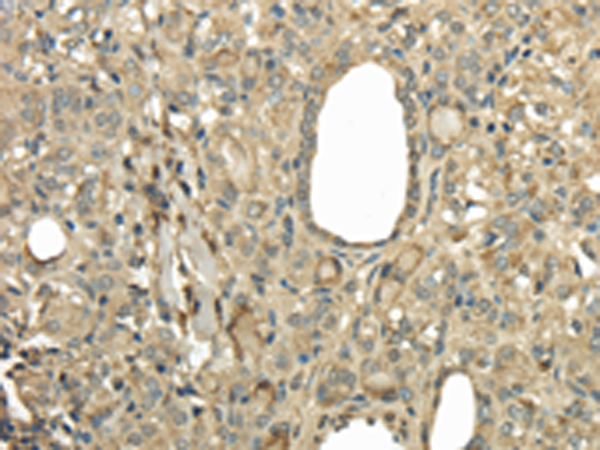 Rabbit Polyclonal Antibody to UBE2B