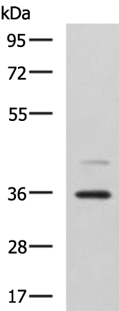 Rabbit Polyclonal Antibody to UBLCP1