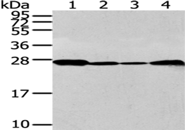 Rabbit Polyclonal Antibody to UCHL3