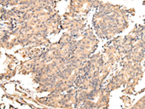 Rabbit Polyclonal Antibody to UGGT2