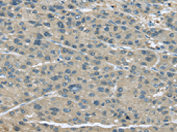 Rabbit Polyclonal Antibody to UGP2
