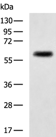 Rabbit Polyclonal Antibody to UGT1A10