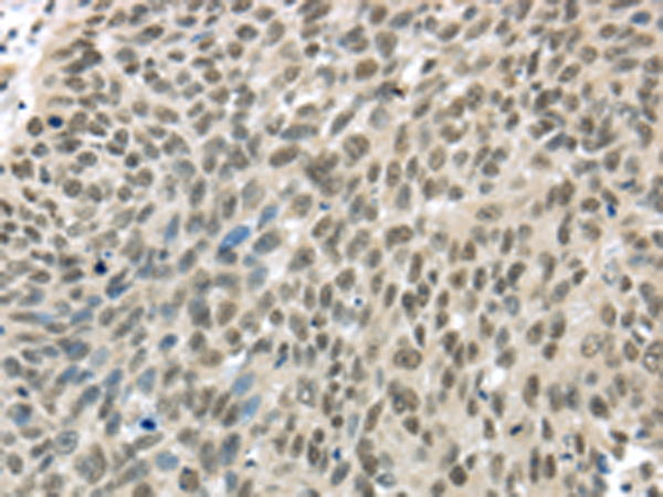 Rabbit Polyclonal Antibody to TBL1Y