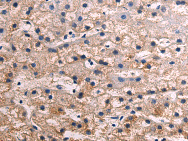 Rabbit Polyclonal Antibody to ITGA5