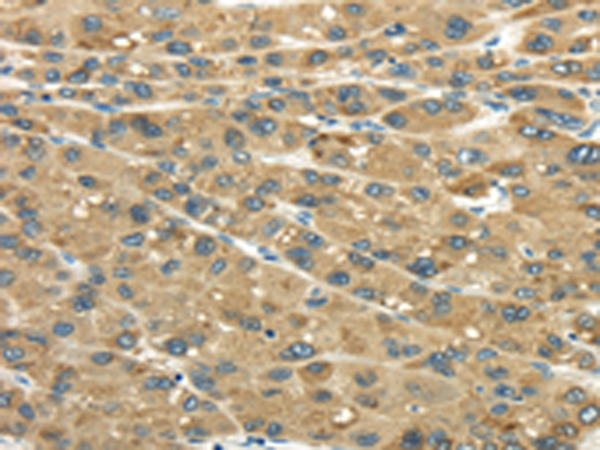 Rabbit Polyclonal Antibody to UGT2B4