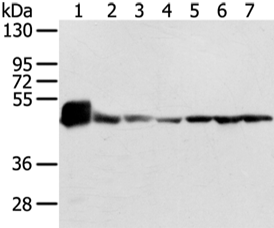 Rabbit Polyclonal Antibody to UQCRC1