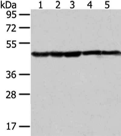 Rabbit Polyclonal Antibody to UQCRC2