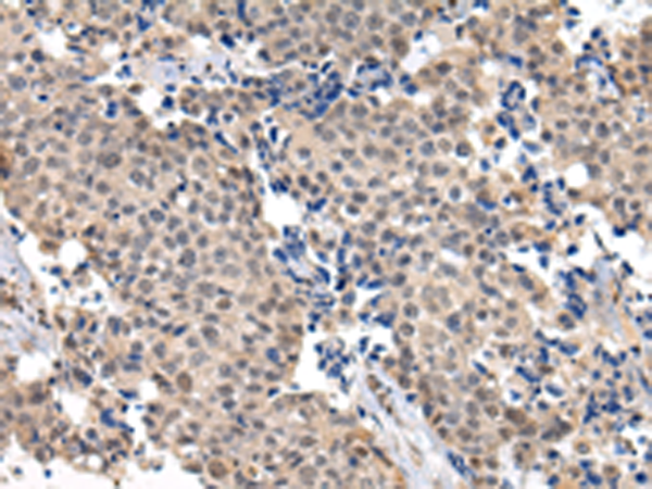 Rabbit Polyclonal Antibody to USF1