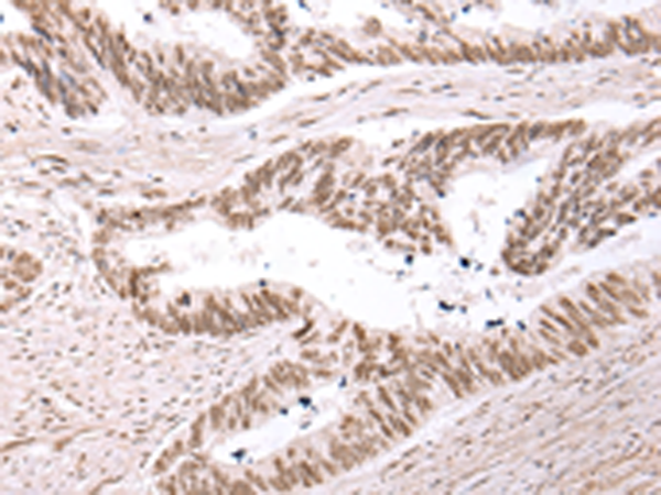 Rabbit Polyclonal Antibody to USP39