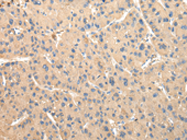 Rabbit Polyclonal Antibody to DUSP11
