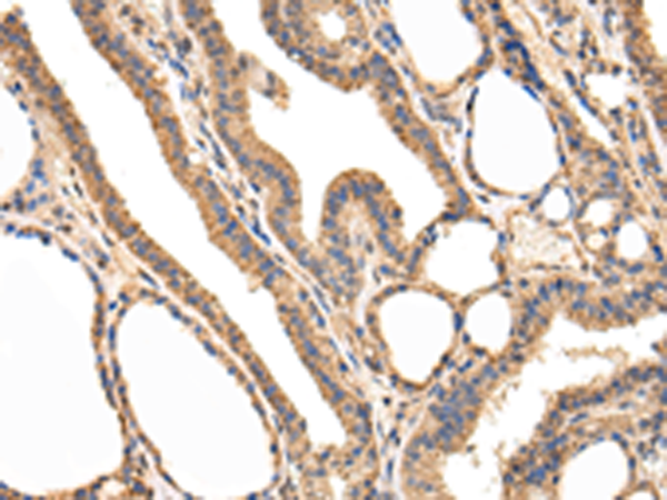 Rabbit Polyclonal Antibody to USP5