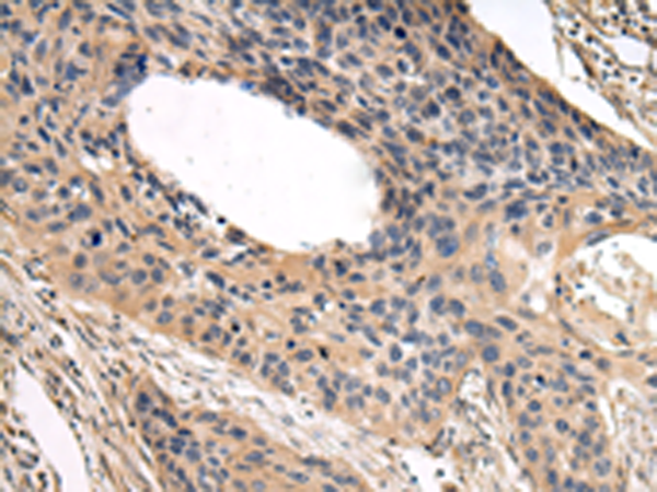 Rabbit Polyclonal Antibody to USP15
