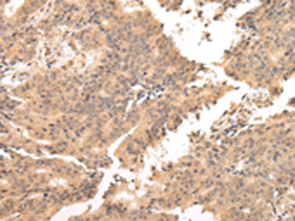 Rabbit Polyclonal Antibody to USP45