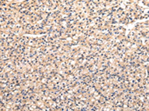 Rabbit Polyclonal Antibody to VAMP5