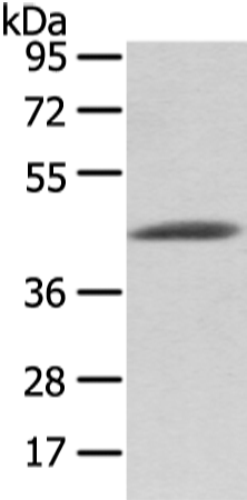 Rabbit Polyclonal Antibody to VASH1