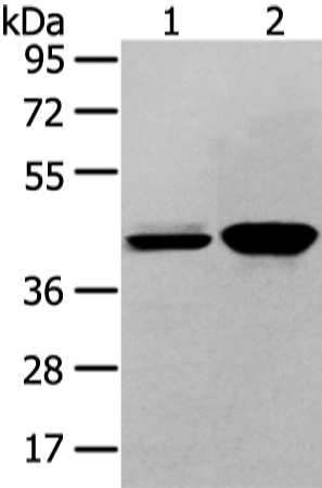 Rabbit Polyclonal Antibody to VASH2