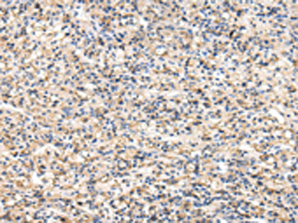 Rabbit Polyclonal Antibody to VCAM1