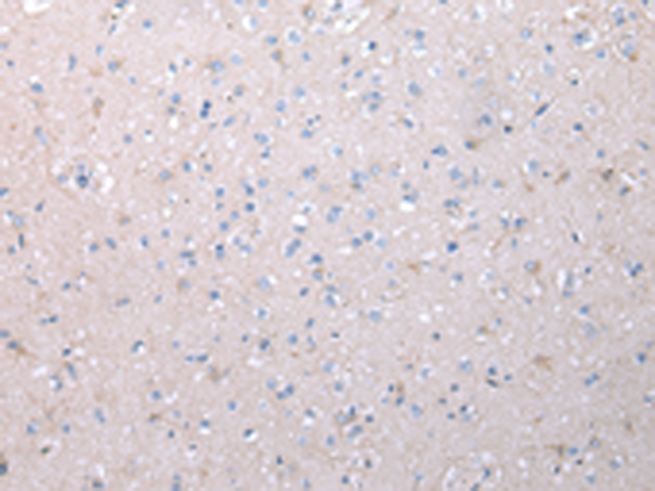 Rabbit Polyclonal Antibody to VCAN