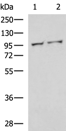 Rabbit Polyclonal Antibody to VIL1