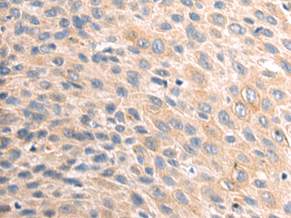 Rabbit Polyclonal Antibody to VIP