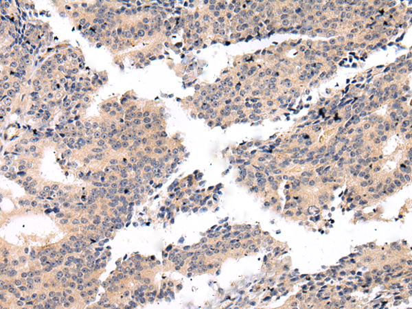 Rabbit Polyclonal Antibody to VSIG8