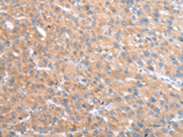 Rabbit Polyclonal Antibody to VPS16