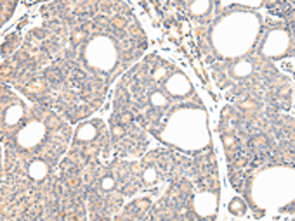 Rabbit Polyclonal Antibody to VPS28