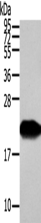 Rabbit Polyclonal Antibody to VPS25