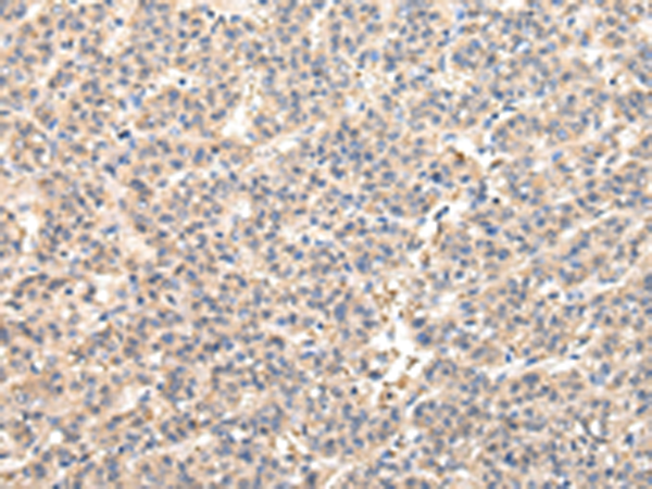Rabbit Polyclonal Antibody to VPS45