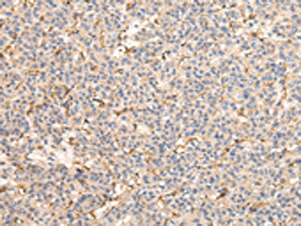 Rabbit Polyclonal Antibody to VPS41