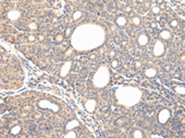 Rabbit Polyclonal Antibody to VPS54