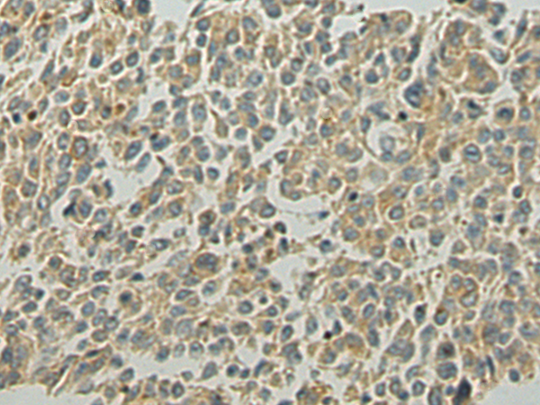 Rabbit Polyclonal Antibody to VPS39