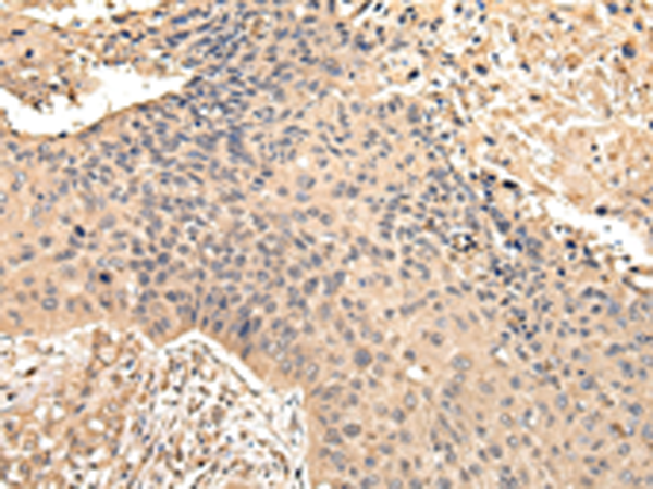 Rabbit Polyclonal Antibody to VPS35