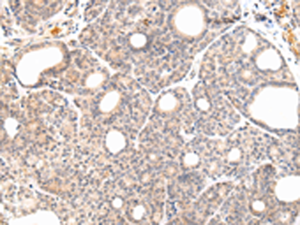 Rabbit Polyclonal Antibody to VPS33A