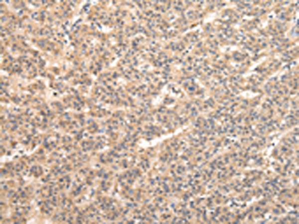 Rabbit Polyclonal Antibody to VPS33B