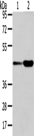 Rabbit Polyclonal Antibody to VPS37A