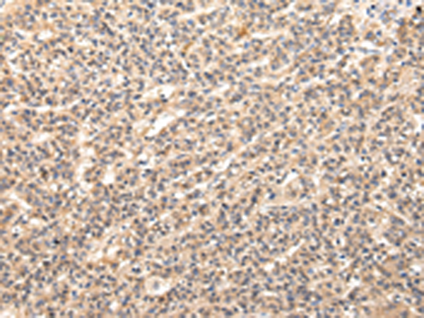 Rabbit Polyclonal Antibody to VPS37D