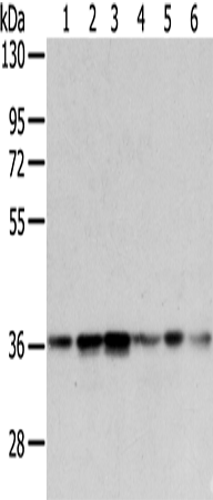 Rabbit Polyclonal Antibody to WDR5