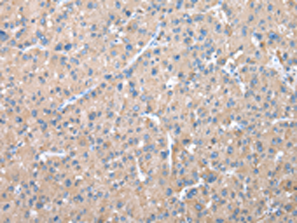 Rabbit Polyclonal Antibody to WDR41
