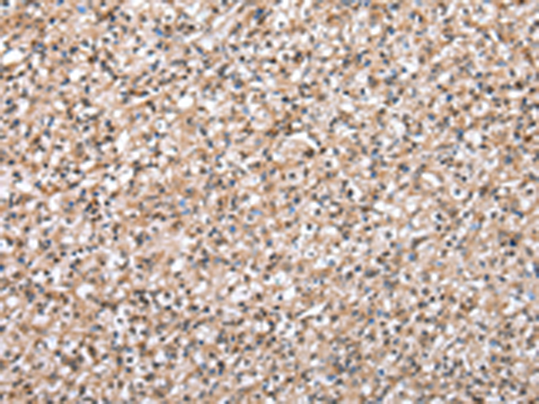 Rabbit Polyclonal Antibody to WDR45